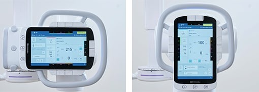 Image:Graphic Display of Unlock Buttons